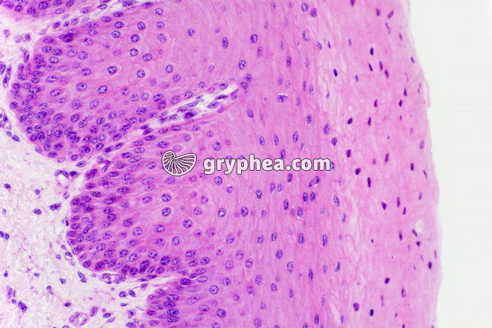 Epithélium stratifié pavimenteux x100 - gryphea.org